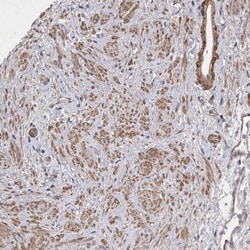 EDEM3 Antibody, Novus Biologicals:Antibodies:Primary Antibodies